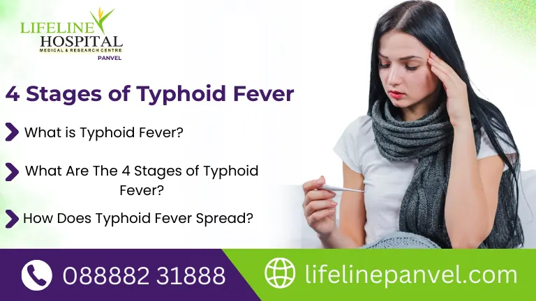 4 Stages of Typhoid Fever