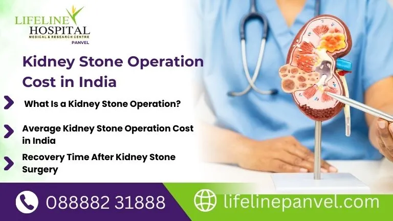 Kidney Stone Operation Cost in India: Save on Surgery!!!