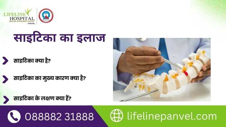 साइटिका का इलाज