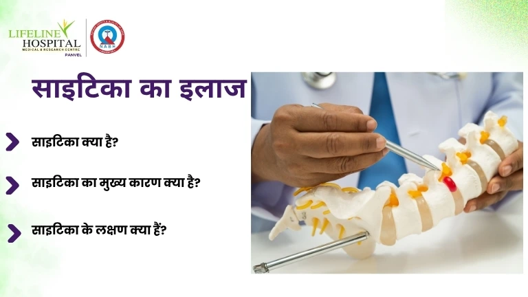 साइटिका का इलाज