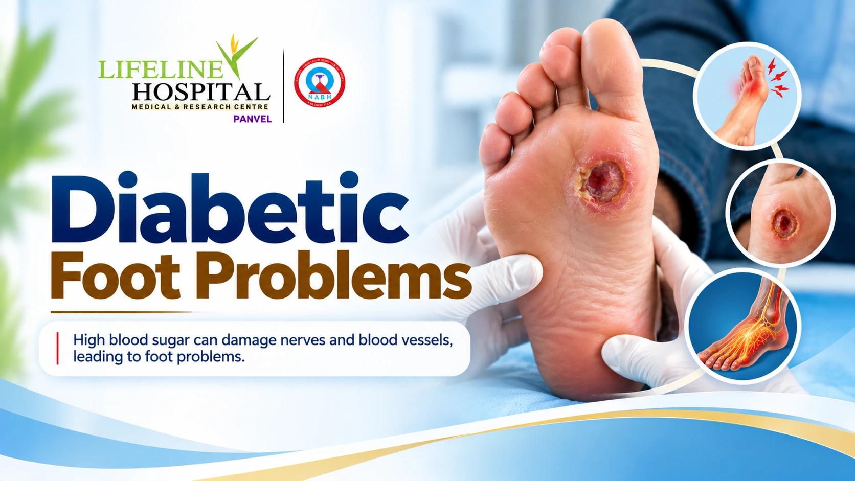 Diabetic Foot Problems