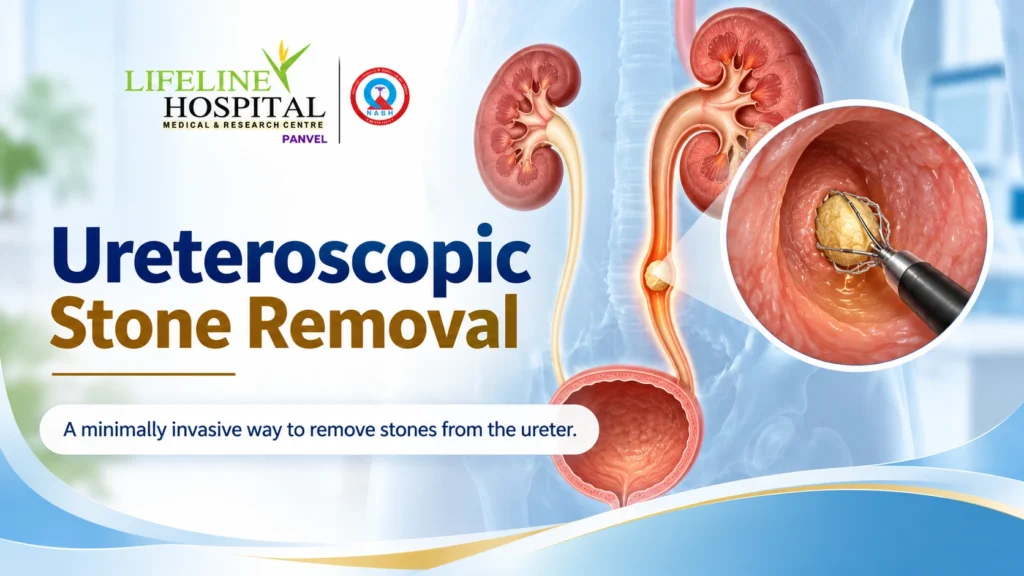 Ureteroscopic Stone Removal